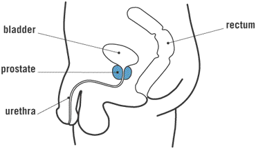 prostate_diagram