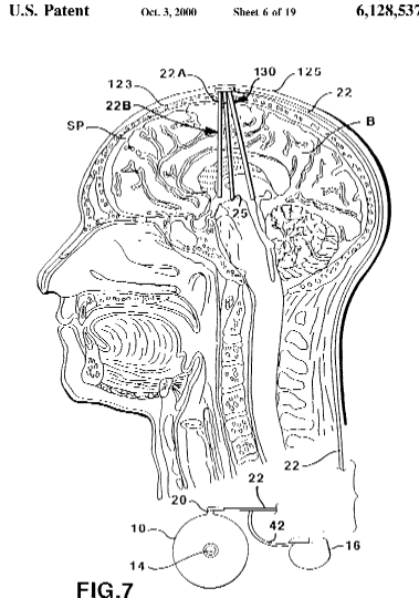 mind-brainspikes