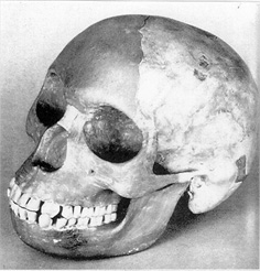 skull