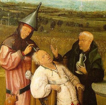 trepanation2