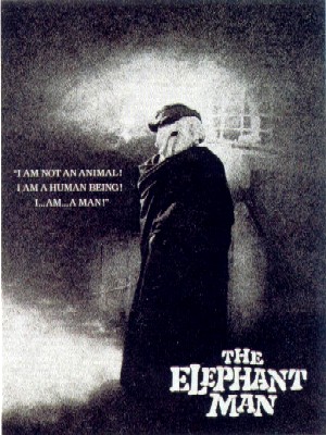 elephantman4